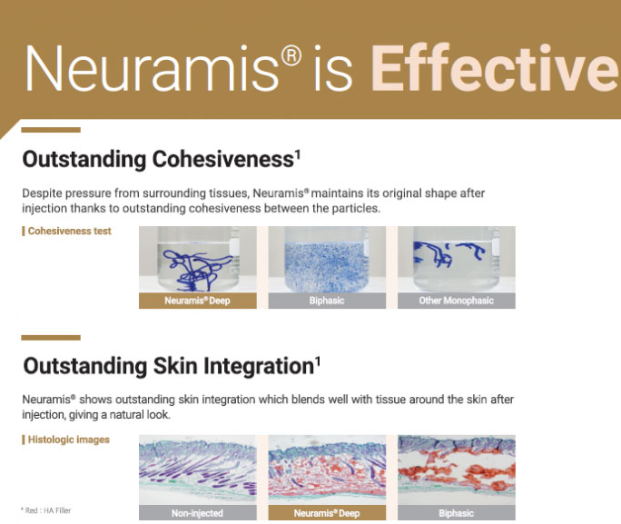 Neuramis with Lidocaine